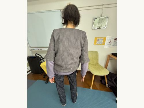 施術前
