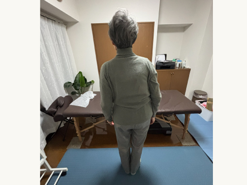 施術後