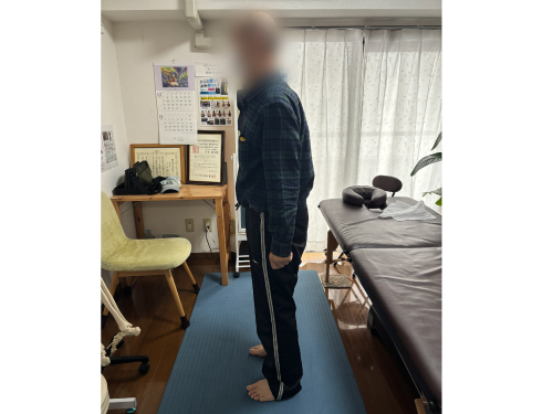 施術後