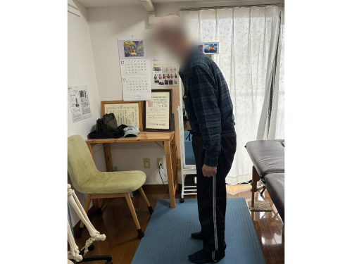 施術前