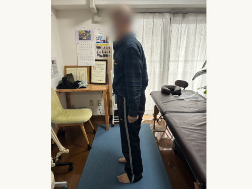 施術後
