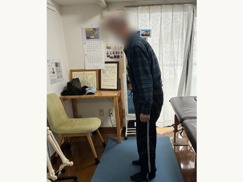 施術前