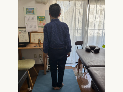施術前